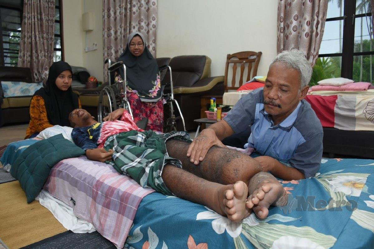 Ramli Mamat, 59, (kanan) melihat keadaan kaki anak bongsunya, Mohammad Arif Hakimi, 21, (baring) sambil diperhatikan isterinya, Murni Md Daud, 58, (berkerusi roda) dan anak kelimanya, Nor Aliah Safiah, 23, di rumah mereka di Kampung Bukit Palas, Cherating. FOTO KHAIRULMIZAN YAHYA