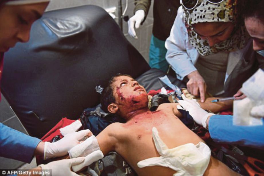 SEORANG kanak-kanak menerima rawatan di sebuah hospital di Syria selepas cedera dalam serangan udara Turki. - AFP