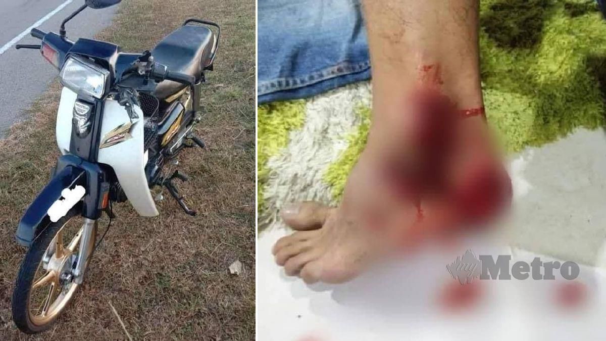 Keadaan seorang lelaki yang cedera selepas motosikal ditungganginya ditendang peragut yang kemudian melarikan beg galas miliknya dalam kejadian di Jalan Sungai Lokan, Seri Pinang, Butterworth. FOTO Ihsan Pembaca