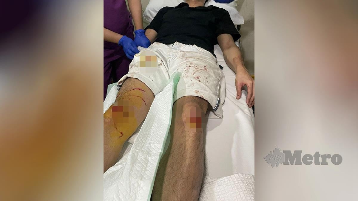 PENJUAL haiwan peliharaan, Ryan Cheah, 26, yang cedera akibat ditetak dalam kejadian samun di Bandar Utama, Petaling Jaya pada 18 Februari lalu.