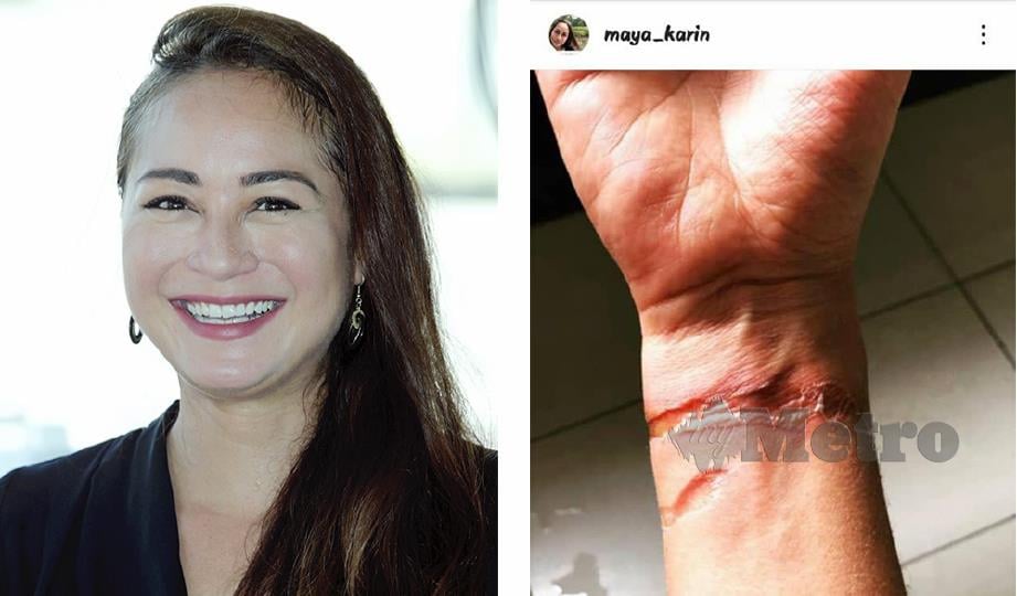 Tangan Maya Karin cedera kena periuk panas  Harian Metro