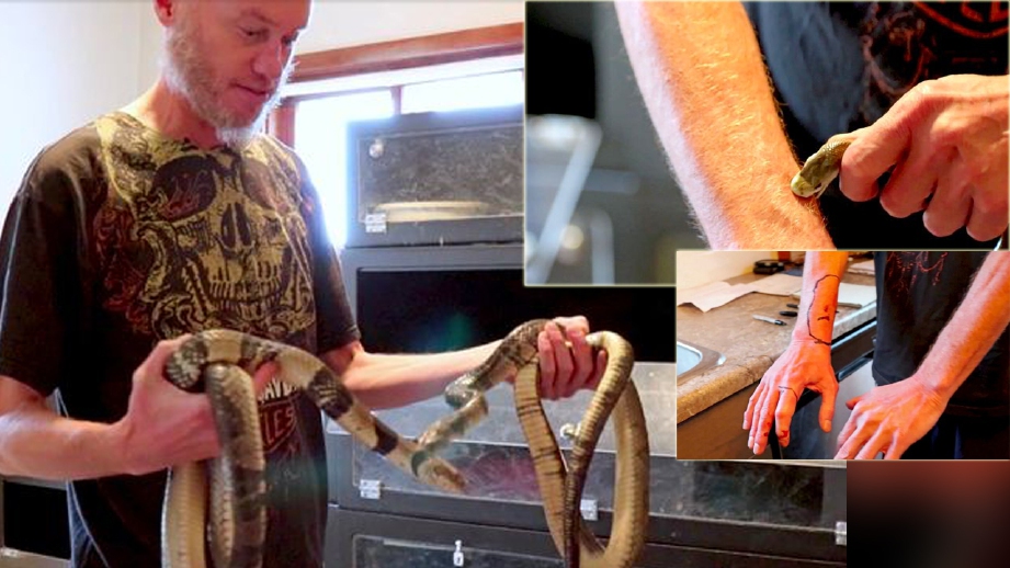 Friede membiarkan ular mematuknya untuk menghasilkan vaksin ular. FOTO Caters News Agency