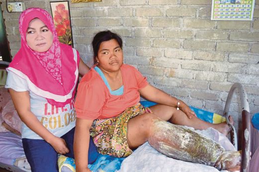 Rusilawati  dari Kampung Bukit Kenak menghidap penyakit untut sejak   2002.