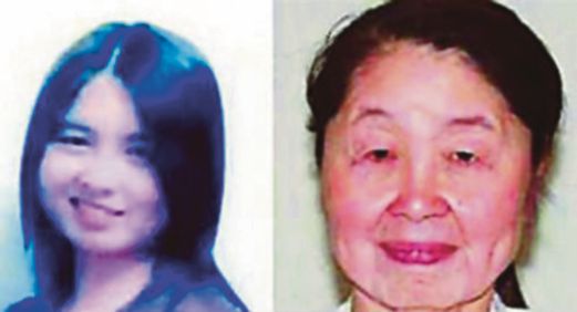WAJAH Hu berubah kerana menghidap penyakit kecelaruan kulit. 