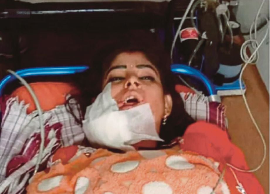 HINA kritikal di hospital selepas ditembak pada muka ketika mengadakan persembahan tarian.