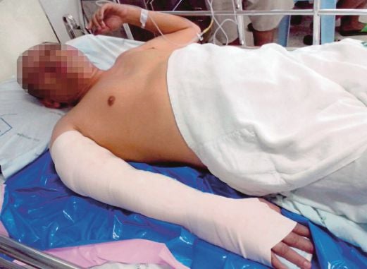  MANGSA   cedera   ditembak  di tangan kanan  dirawat  di  Hospital Sungai Golok.  