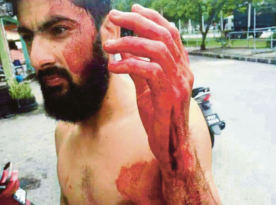SEORANG daripada empat pekerja warga Pakistan cedera selepas diserang lelaki bersenjatakan pedang samurai.