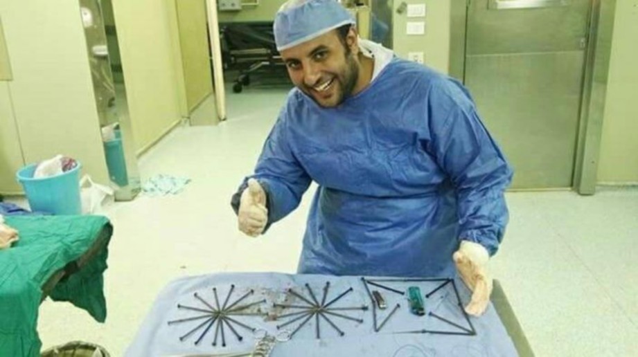 DR Abdulrahman menunjukkan paku dan logam lain, termasuk pemetik api yang dikeluarkan dari perut seorang pesakit. - Agensi 
