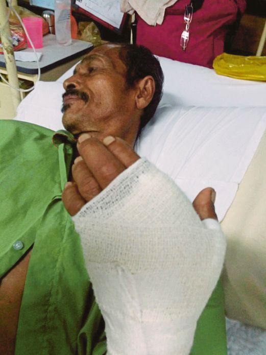 Mohammad Ghazali menunjukkan tangan kirinya hampir putus  selepas  digigit  kera peliharaannya.