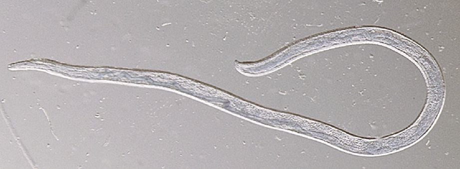 CACING parasit Thelazia gulosa betina dewasa yang dikeluarkan dari mata wanita berkenaan. - Reuters
