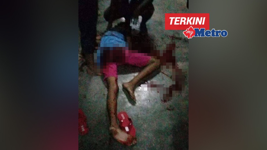 GAMBAR remaja parah selepas diserang yang tular di Facebook.