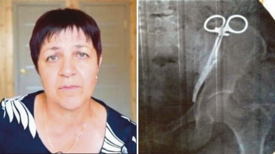 EZETA dan gambar X-ray yang menunjukkan kedudukan gunting dalam perut wanita itu. FOTO Agensi.