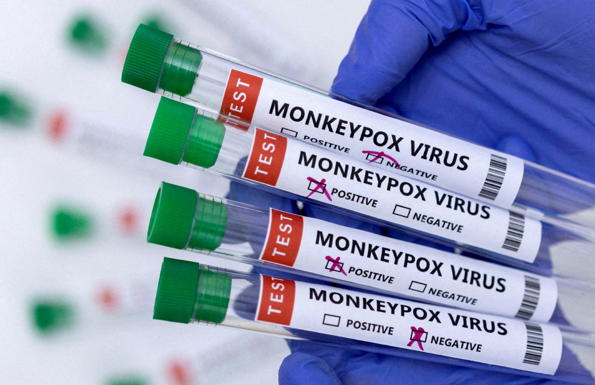 TIUB sampel virus cacar monyet. FOTO Reuters.