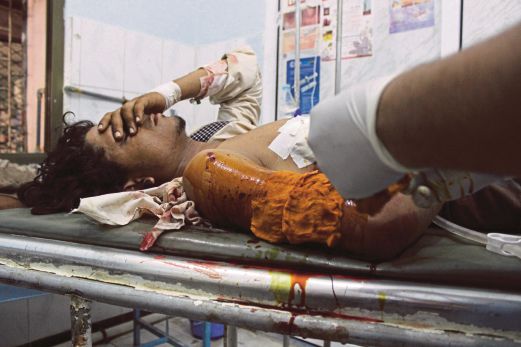 SEORANG lelaki Yaman dibawa ke hospital selepas cedera dalam pertempuran di Taez, semalam.  