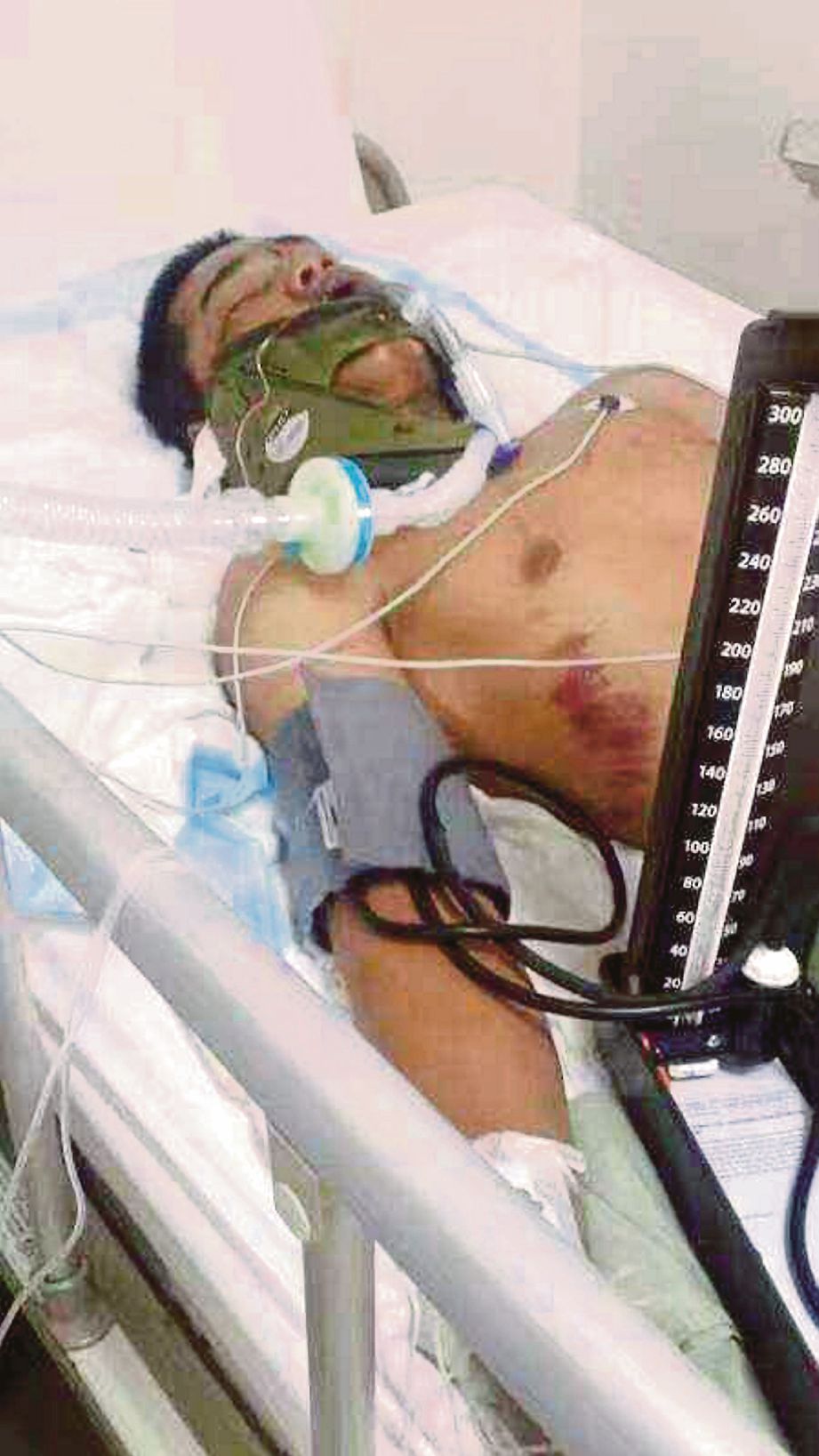  Muhammad Shahrul Asri ketika dirawat di Hospital Melaka.