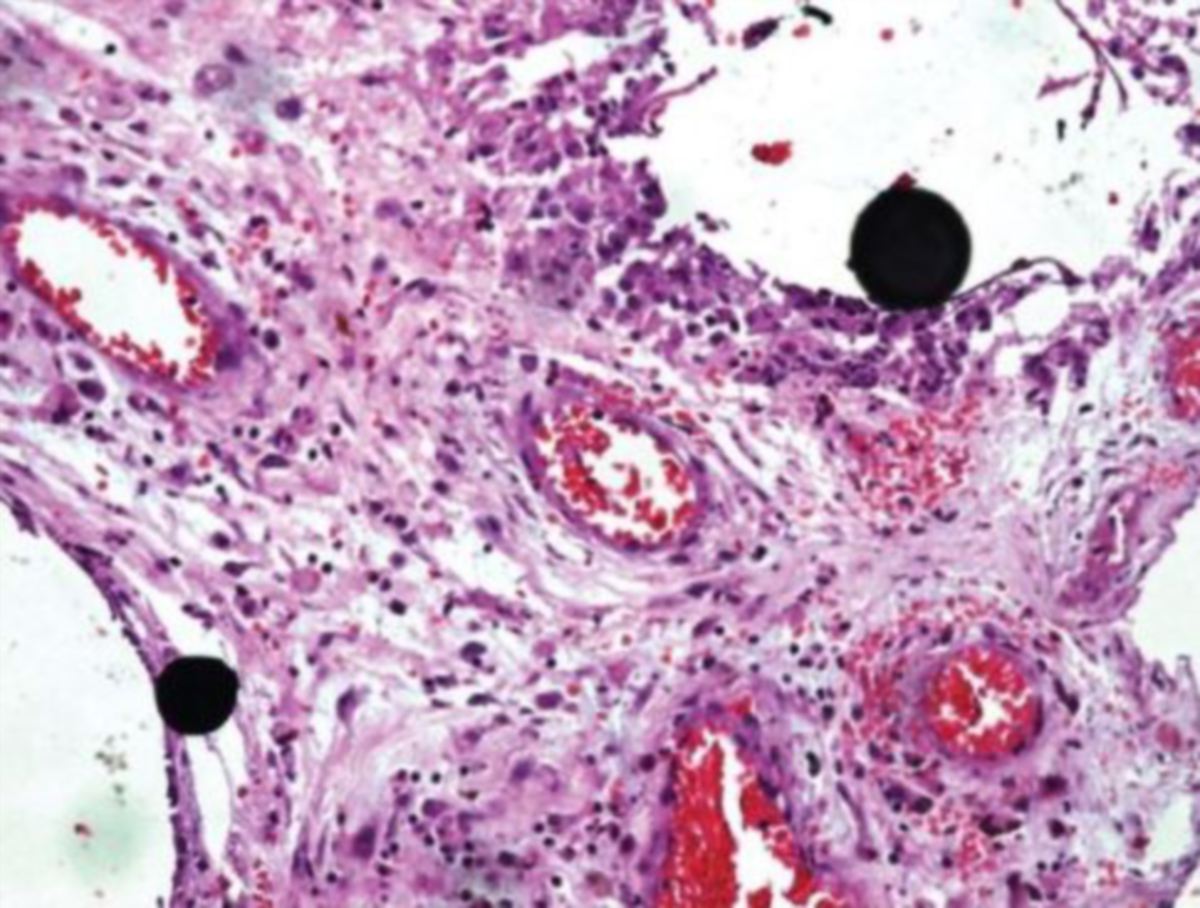 IMEJ menunjukkan merkuri dalam sel badan remaja itu. FOTO NCBI
