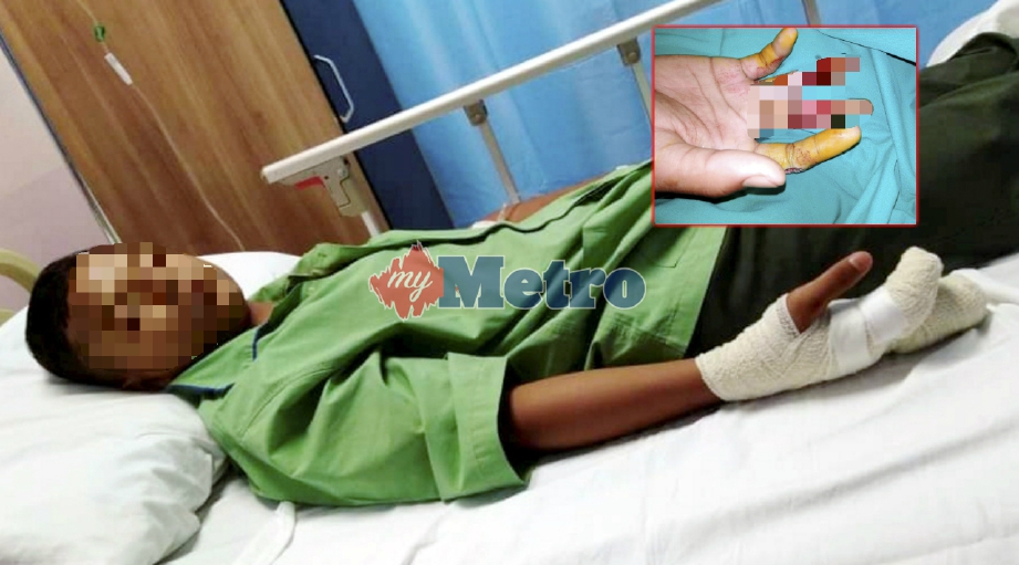 MANGSA dirawat di Hospital Sultanah Nora Ismail (HSNI), Batu Pahat, Johor selepas dua jari tangan kanannya hampir putus akibat terkena mesin kayu di sekolahnya Ayer Hitam, Batu Pahat, semalam. FOTO Essa Abu Yamin.
