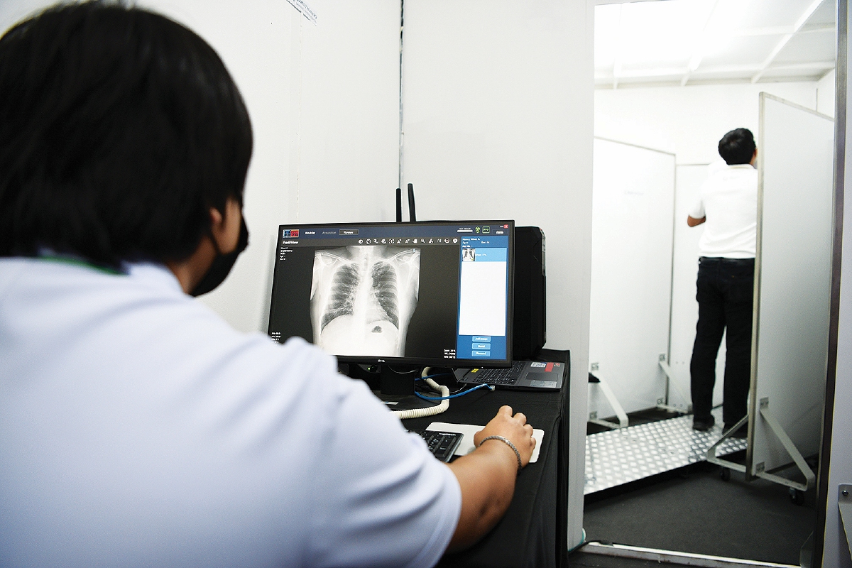 ALAT X-ray AI menggunakan algoritma pembelajaran mendalam untuk mengesan keabnormalan pada radiografi dada.