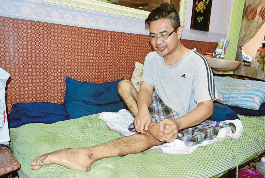Mohd Khairol  melakukan rawatan fisioterapi pada bahagian kakinya akibat kecederaan tulang belakang sejak hampir 13 tahun lalu di rumahnya di Taman Impian, Alma, Bukit Mertajam. 
