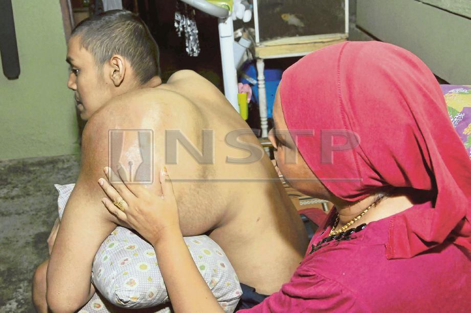  SALMI Shafie memeriksa bahu kiri anaknya, Mohd Shafuan  sebelum menerima rawatan kimoterapi kerana menghidap barah tulang.  