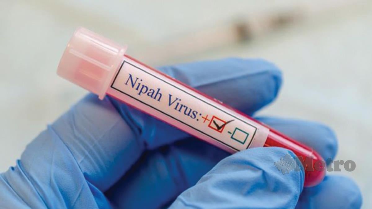 MASIH tiada vaksin untuk merawat jangkitan virus Nipah. 