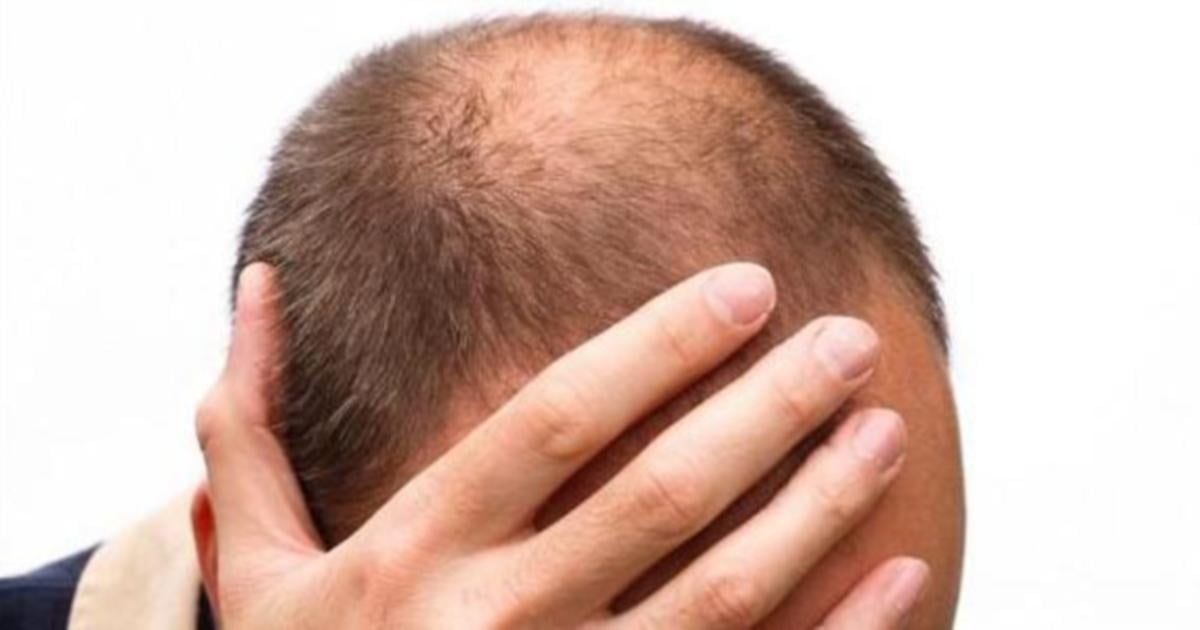 Alpecin penyelesaian masalah rambut lelaki