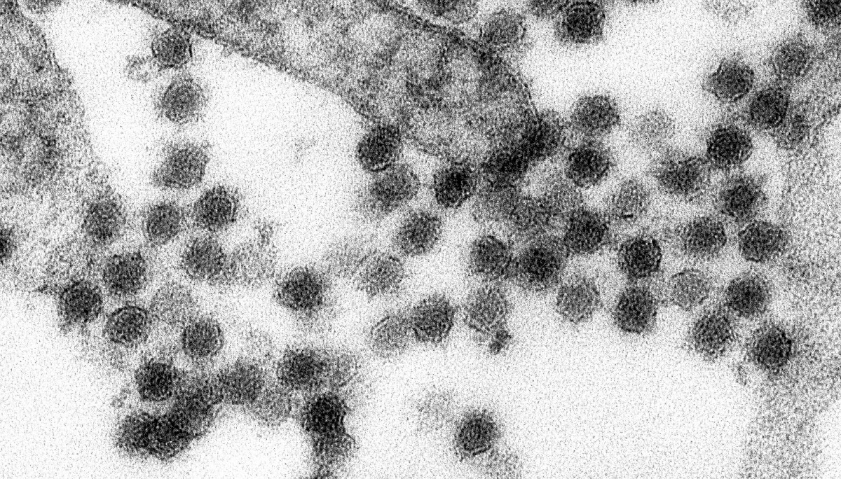 IMEJ menunjukkan Virus Nil Barat. FOTO Pusat Kawalan dan Pencegahan Penyakit (CDC) Amerika Syarikat/ AFP 