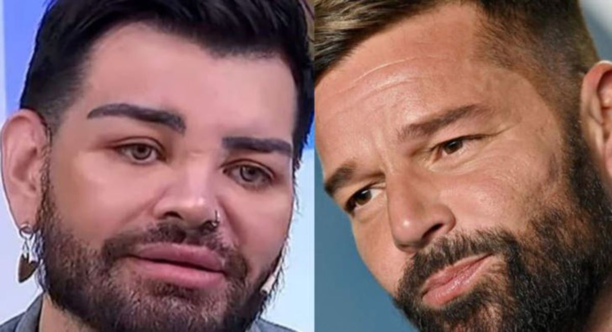 FRAM Mariano (kiri) menjalani pelbagai prosedur untuk meniru wajah Ricky Martin (kanan). 