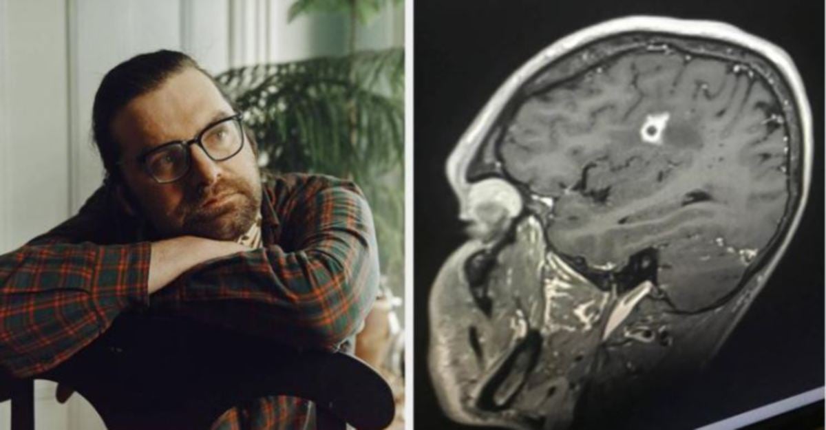 TYSON Bottenus menderita jangkitan kulat hitam di dalam otak. FOTO Agensi 
