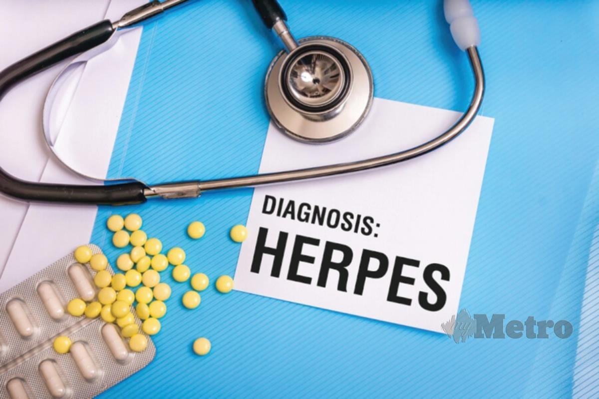KUDIS herpes dirawat dengan ubat antiviral. 