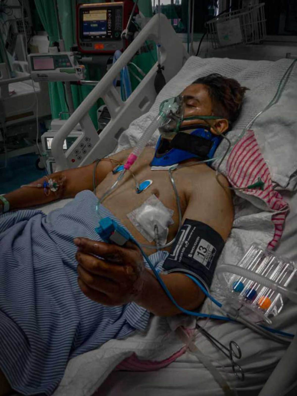 DANIAL ketika dimasukkan ke hospital akibat kemalangan jalan raya Aidilfitri lalu. FOTO Ihsan Dhia Danial Zaidudin