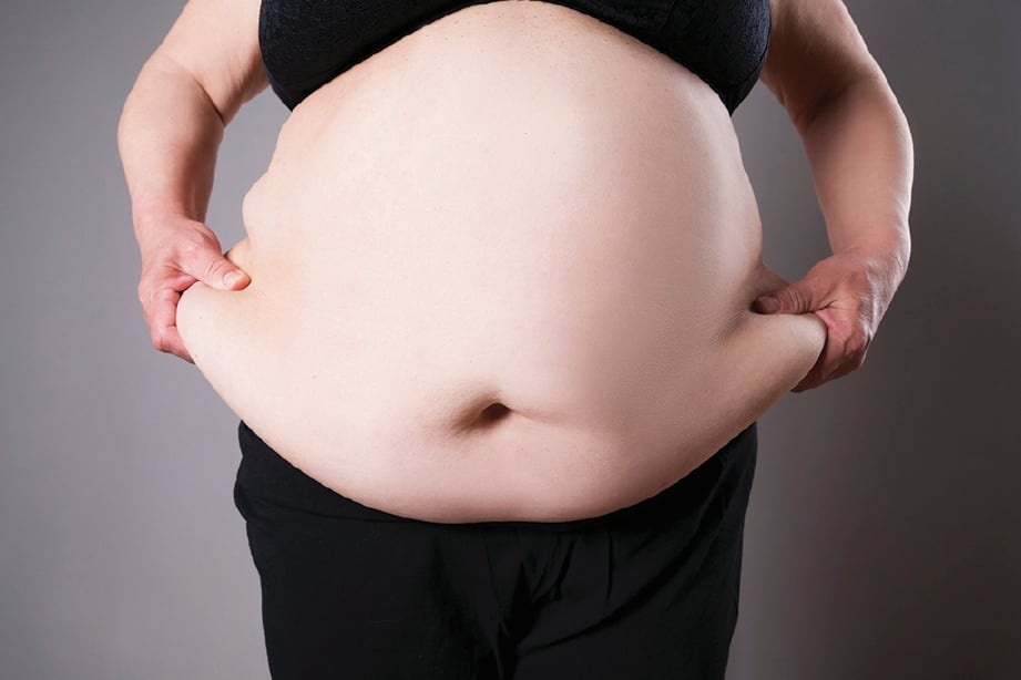 OBESITI dalam kalangan wanita boleh memberi kesan buruk ketika hamil.