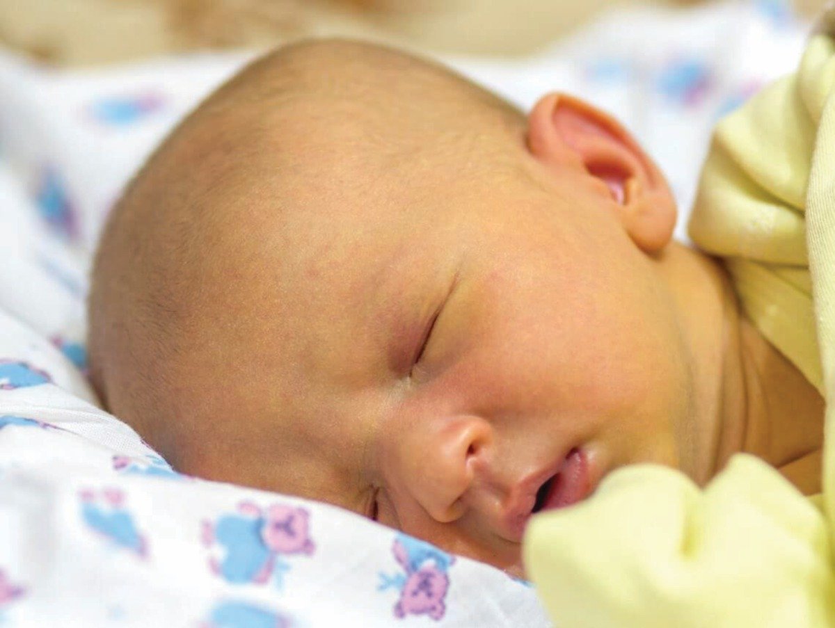 JAUNDIS menyebabkan bayi tampak kekuningan.