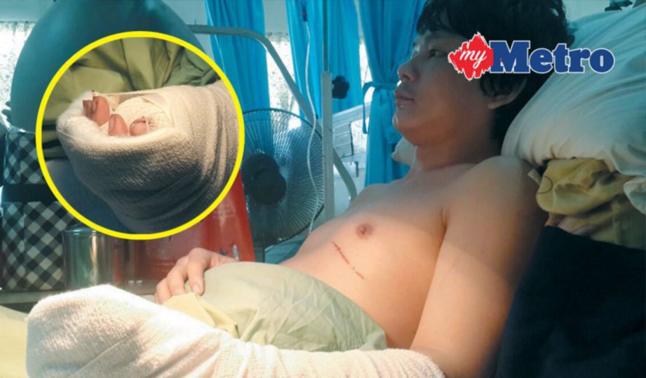 LIM kini dirawat di HKL. Gambar kecil, tangan kiri Lim yang cedera akibat ditetak penyamun.