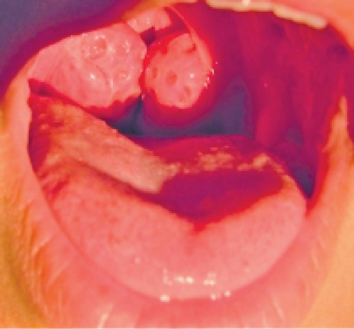 WANITA berdengkur lebih cenderung mengalami masalah lelangit lembut yang panjang hingga menutup rongga pernafasan di belakang lidah.