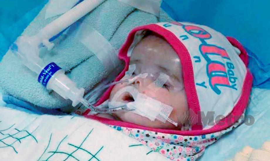 KYFA Nishka Al-Kautsar Mohd Farham, bayi berusia empat bulan lebih yang menghidap kanser otak tahap empat dan kanser buah pinggang kini kritikal dan menerima rawatan di Unit Dependensi Tinggi (HDU) Hospital Universiti Sains Malaysia (HUSM), Kubang Kerian. FOTO Ihsan Keluarga