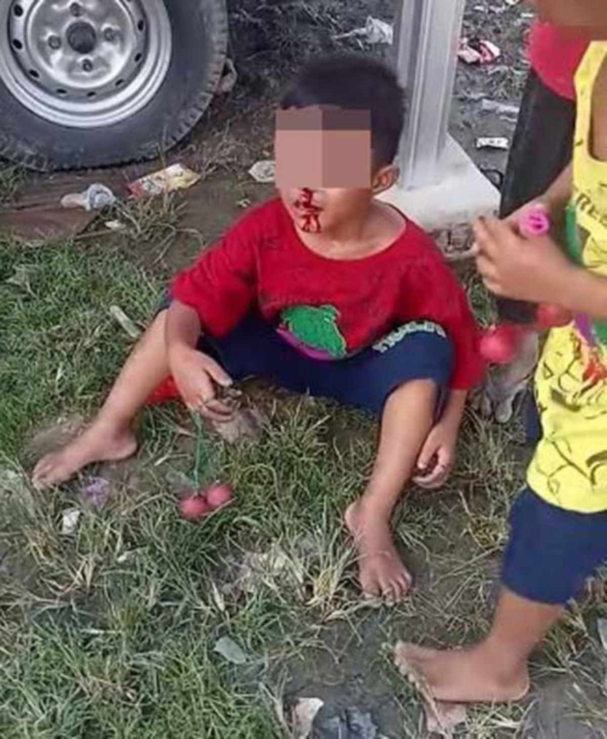 TANGKAP layar rakaman video yang menunjukkan seorang kanak-kanak di luar negara cedera selepas bermain lato-lato.