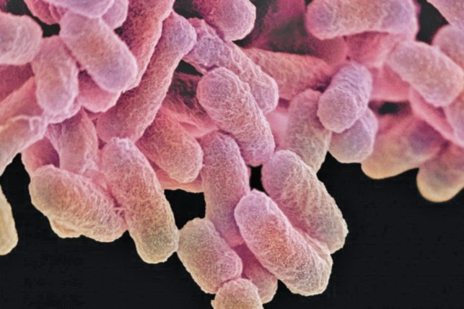 BAKTERIA mikrobakterium tuberkulosis ejen penyebab tibi.