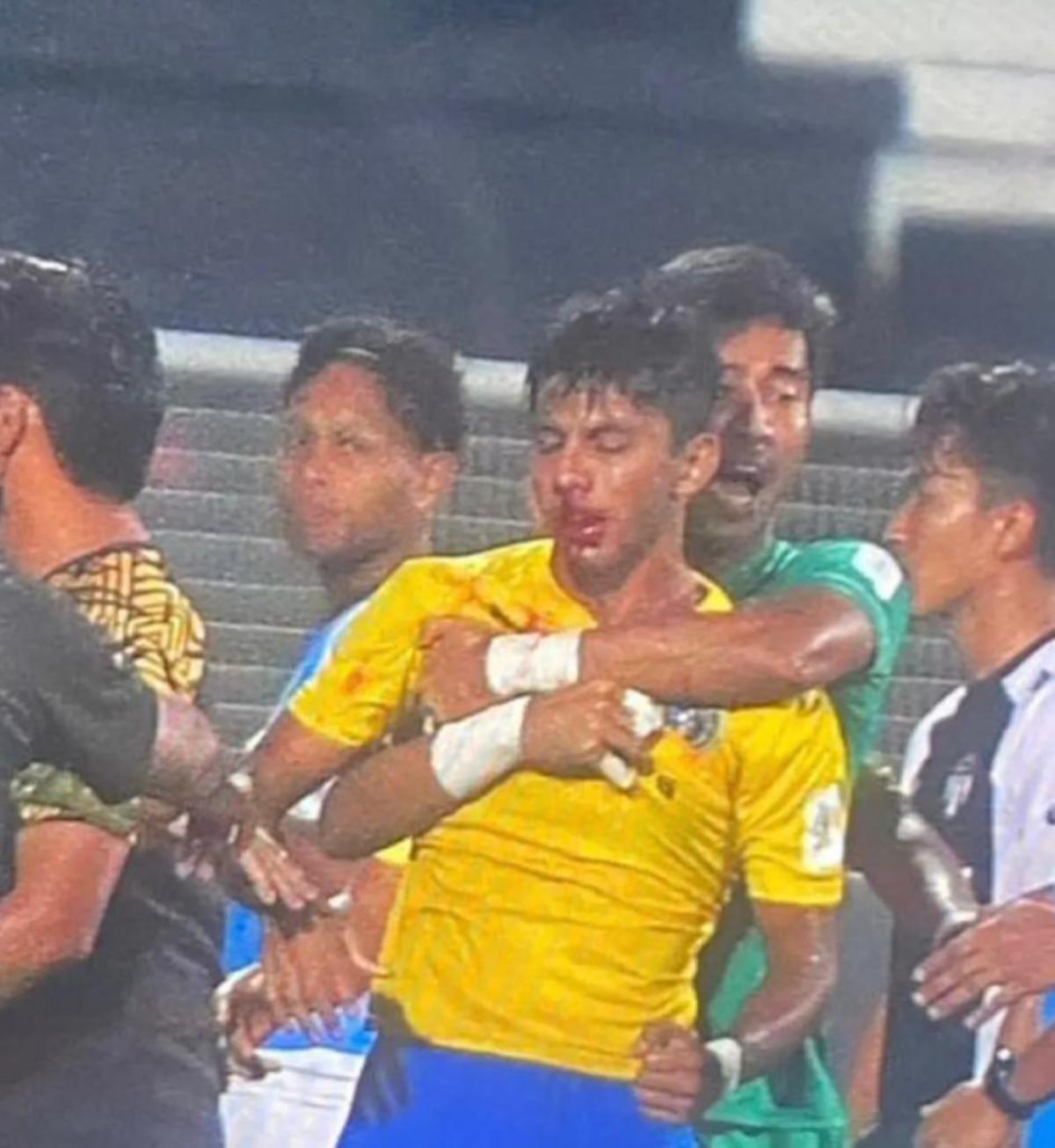 Pemain Penang FC, Adib Raof berlumuran darah di bahagian hidung ketika insiden pergaduhan malam tadi.