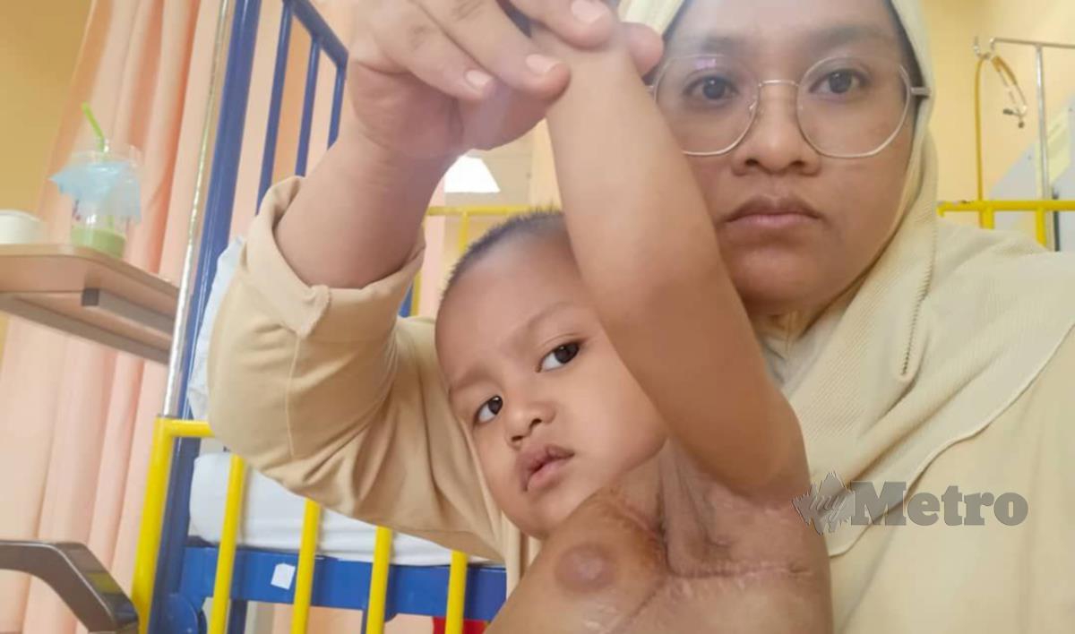 Siti Nazirah menunjukkan parut pembedahan anaknya yang menghidap kanser 'Infantile Fibrosarcoma'. FOTO Ihsan Siti Nazirah.