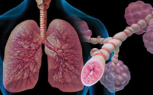 BRONKIOL di dalam paru-paru jadi sempit ketika diserang asma.