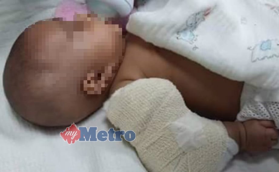 BAYI lelaki berusia tiga bulan patah tangan kanan dipercayai akibat didera pengasuhnya di Seri Iskandar, semalam. FOTO ihsan polis.