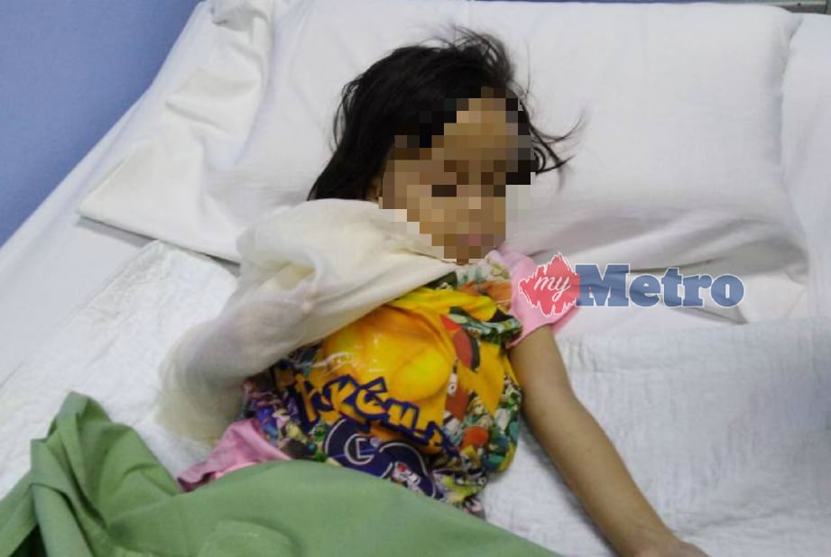 MANGSA yang patah tangan kanan dan mengalami beberapa kecederaan di badan akibat didera ibu saudaranya kini dan dilaporkan stabil dan dirujuk ke Hospital Sibu. FOTO ihsan polis. 
