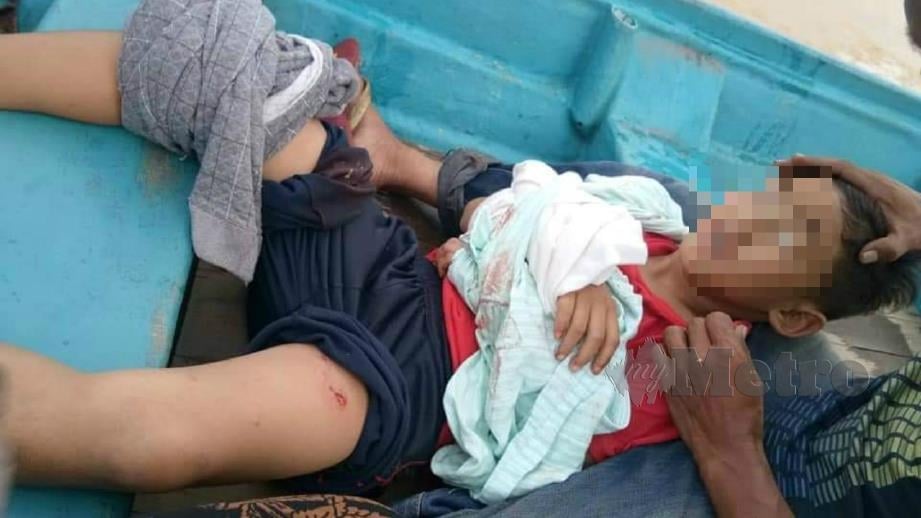 Muhammad Putra Rafiqi parah selepas diserang beruk jantan di Kampung Teluk Renjuna di Tumpat. FOTO ihsan keluarga mangsa