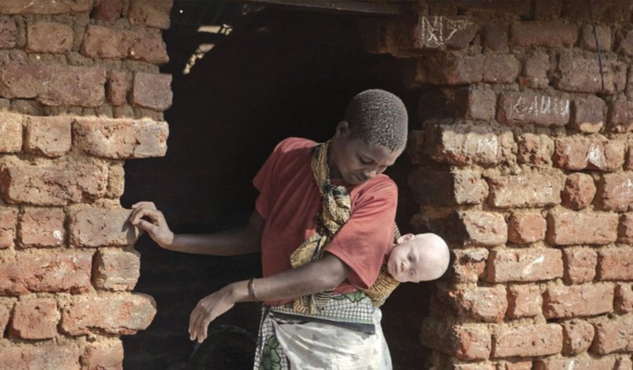 WANITA yang melarikan diri ke pusat itu bersana anaknya yang albino turut menjaga kanak-kanak lain yang ditinggalkan keluarga mereka.