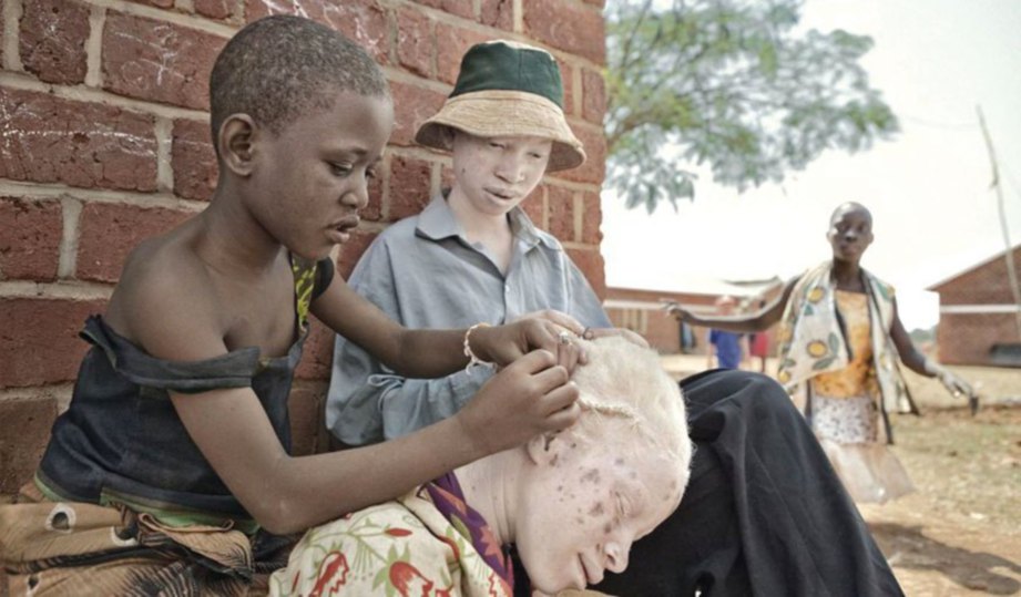 SEORANG kakitangan menocang rambut seorang wanita albino di kawasan redup untuk mengelak tindak balas terhadap cahaya matahari.