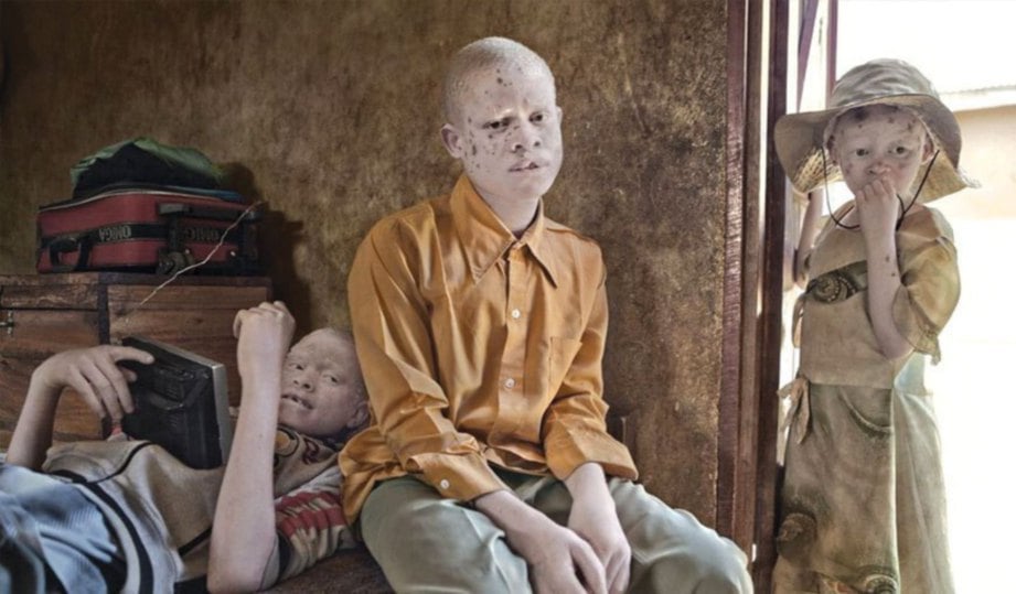 KERAJAAN Tanzania membina pusat itu untuk melindungi albino yang melarikan diri daripada kekejaman.