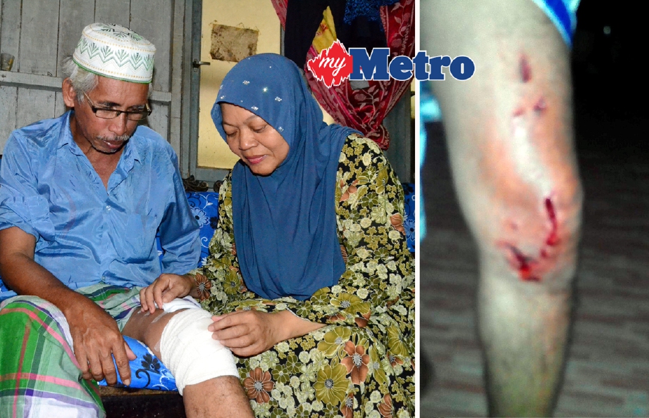 Salmah Isa, 47, membalut luka pada kaki suaminya Ibrahim Nor, 58, yang cedera akibat dibaham buaya di pinggir Sungai Gong Ketereh, Tok Ajam, Ahad lalu. - Foto Bernama
