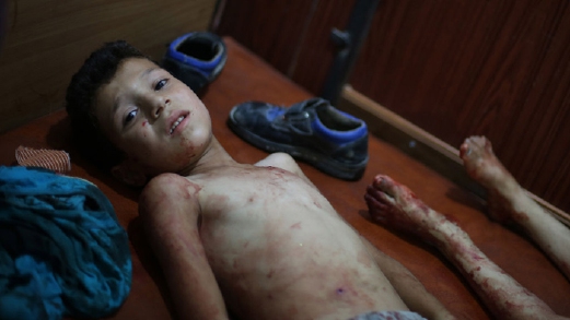 Antara kanak-kanak yang cedera akibat serangan udara di Douma yang membunuh lebih 100 orang semalam. - Foto Chanel4,com 