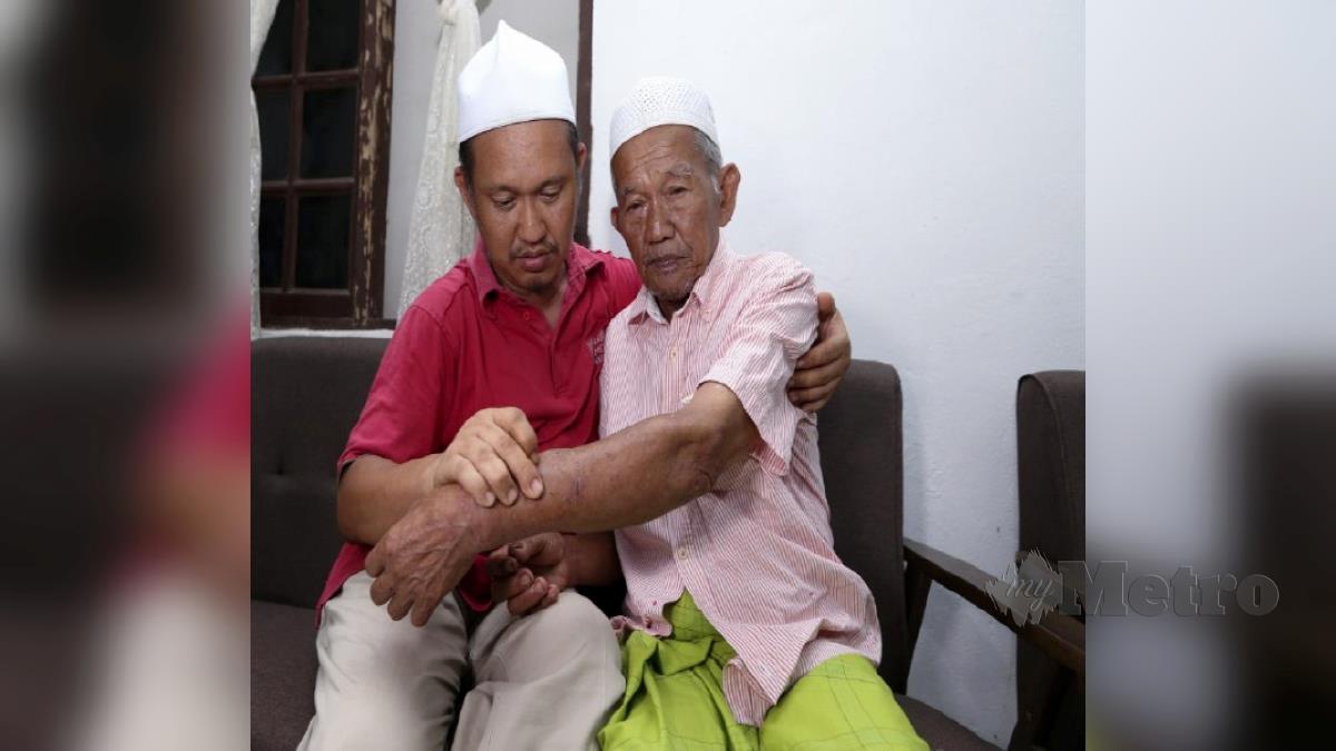 ANAK kepada Yaakub Ismail, 76 menunjukkan kecederaan tangan dialami bapanya selepas sesat tujuh hari di kebun buah miliknya di Kampung Pasir Dusun, Jeli. FOTO NIK ABDULLAH NIK OMAR